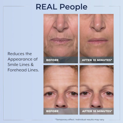Rapid Reduction Serum